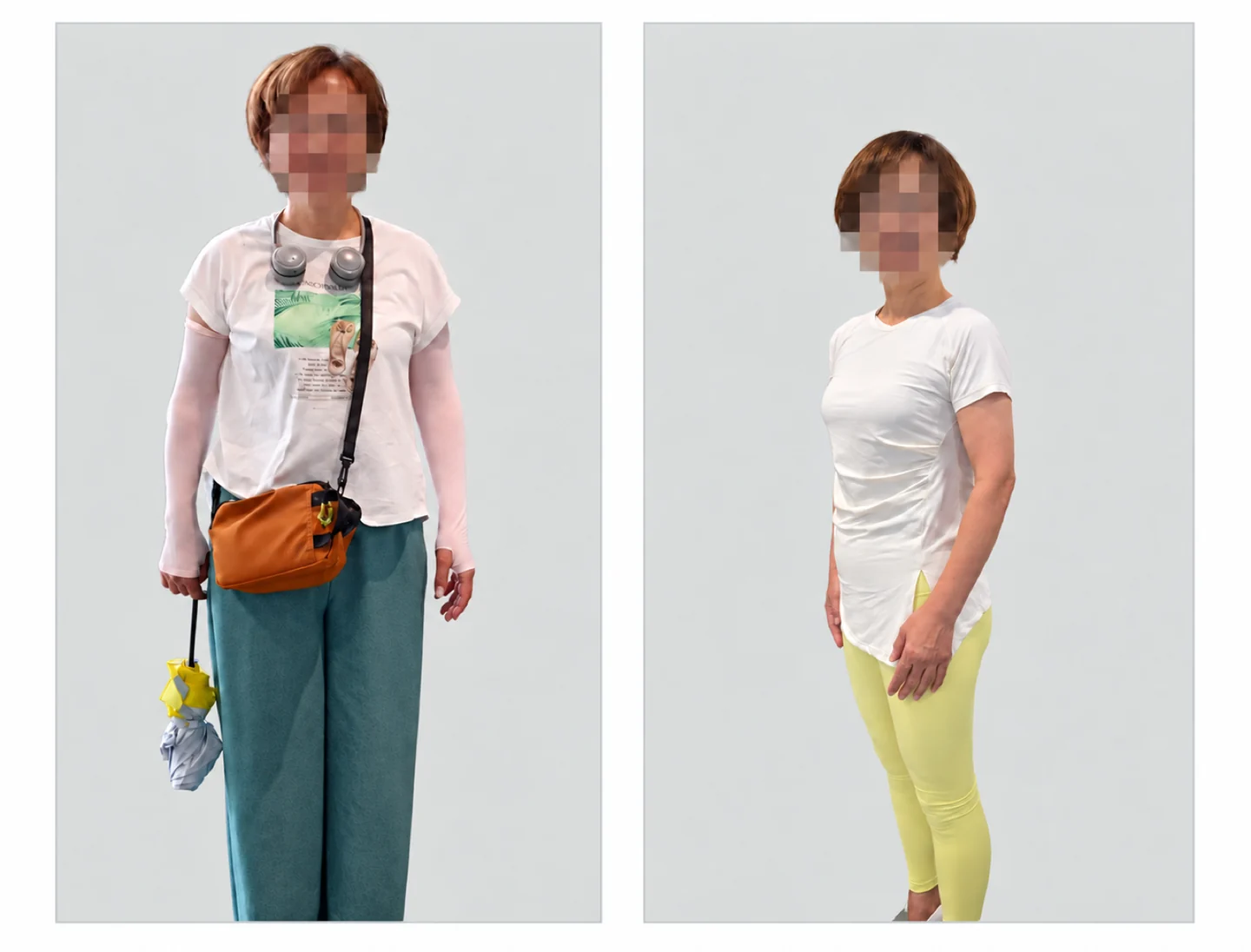 60代のお客様の比較写真。顔は匿名化されています